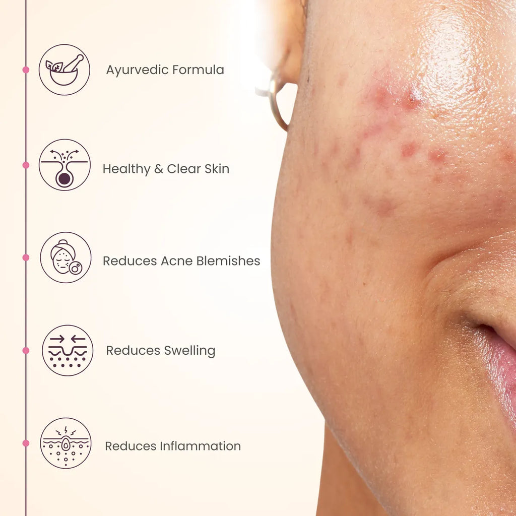 Acne Controll Gel 50 Gm For Clear Healthy Skin